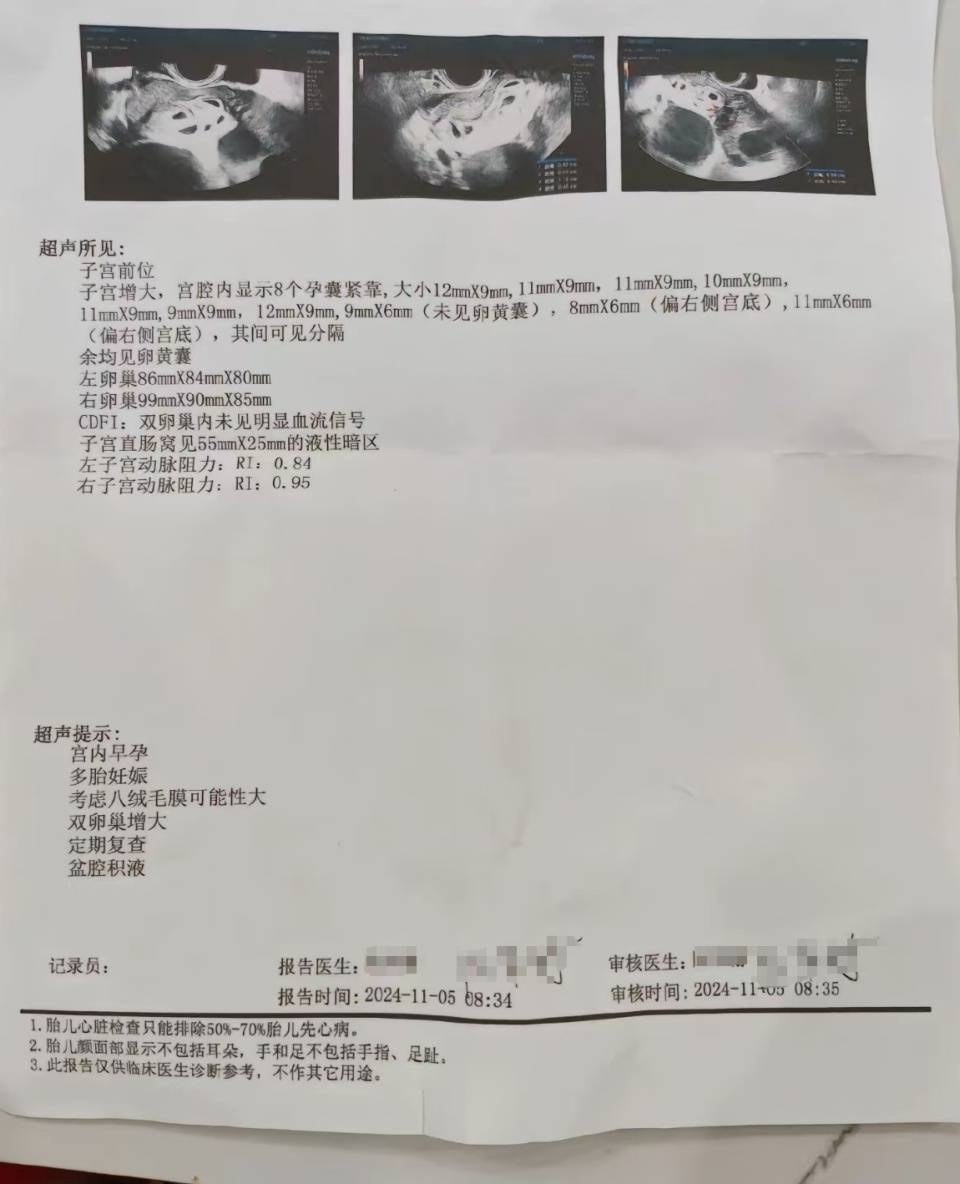 怀9胞胎当事人做第二次减胎手术，丈夫发声：妻子怀孕实在太辛苦了，希望平安顺利