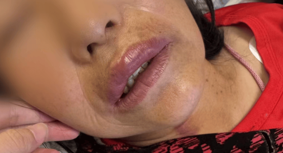 “差点要我命了！”杭州女子在阳台上被突袭！台风前后高发，千万当心，赶紧提醒家人